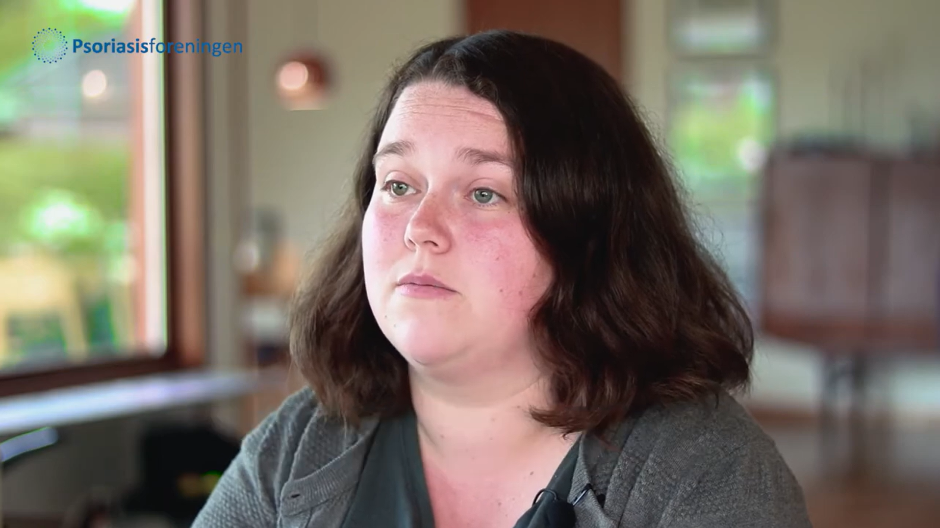 - Rikke giver sine bedste råd til andre med psoriasisgigt